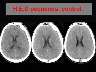 H.E.D pequeños: control.  