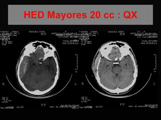 HED Mayores 20 cc : QX 