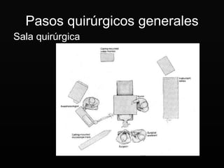 Pasos quirúrgicos generales Sala quirúrgica 