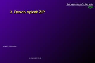 Acidentes em Endodontia PQM 3. Desvio Apical/ ZIP SOARES; GOLDBERG LEONARDO; LEAL 