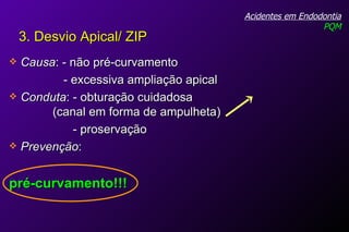 Causa : - não pré-curvamento    - excessiva ampliação apical Conduta : - obturação cuidadosa  (canal em forma de ampulheta) - proservação Prevenção : pré-curvamento!!! Acidentes em Endodontia PQM 3. Desvio Apical/ ZIP 