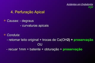 Causas : - degraus - curvaturas apicais Conduta :  - retomar leito original + trocas de Ca(OH 2) +  proservação OU - recuar 1mm + batente + obturação +  proservação Acidentes em Endodontia PQM 4. Perfuração Apical 