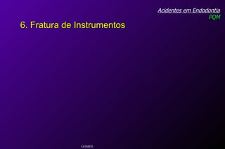 Acidentes em Endodontia PQM GOMES 6. Fratura de Instrumentos 