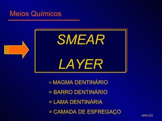 Meios Químicos


            SMEAR
             LAYER
          = MAGMA DENTINÁRIO

          = BARRO DENTINÁRIO
          = LAMA DENTINÁRIA
          = CAMADA DE ESFREGAÇO
                                  APKV/03
 