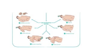 Escala de Coma de Glasgow
 