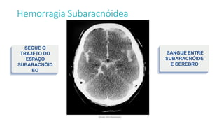 Hemorragia Subaracnóidea
SANGUE ENTRE
SUBARACNÓIDE
E CÉREBRO
SEGUE O
TRAJETO DO
ESPAÇO
SUBARACNÓID
EO
(fonte: Shutterstock).
 