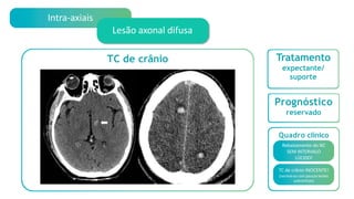 Intra-axiais
Tratamento
expectante/
suporte
Prognóstico
reservado
Quadro clínico
Rebaixamento do NC
SEM INTERVALO
LÚCIDO!
TC de crânio INOCENTE!
(normal ou com poucas lesões
subcorticais)
Lesão axonal difusa
TC de crânio
 