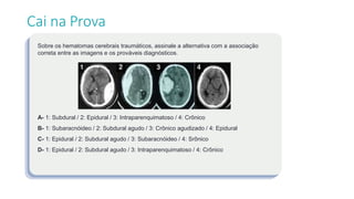 Sobre os hematomas cerebrais traumáticos, assinale a alternativa com a associação
correta entre as imagens e os prováveis diagnósticos.
A- 1: Subdural / 2: Epidural / 3: Intraparenquimatoso / 4: Crônico
B- 1: Subaracnóideo / 2: Subdural agudo / 3: Crônico agudizado / 4: Epidural
C- 1: Epidural / 2: Subdural agudo / 3: Subaracnóideo / 4: Srônico
D- 1: Epidural / 2: Subdural agudo / 3: Intraparenquimatoso / 4: Crônico
Cai na Prova
 