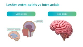 Lesões extra-axiais vs intra axiais
Extra-axiais Intra-axiais
 