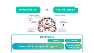 Hematoma epidural Hematoma subdural
VS
Craniotomia + drenagem de urgência
Tratamento
Agudo Crônico
Drenagem eletiva
ou expectante
 