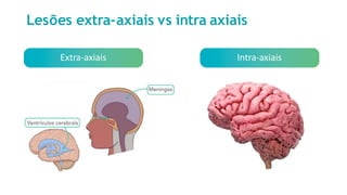 Lesões extra-axiais vs intra axiais
Extra-axiais Intra-axiais
 