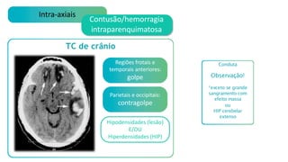 Intra-axiais
Contusão/hemorragia
intraparenquimatosa
TC de crânio
Regiões frotais e
temporais anteriores:
golpe
Parietais e occipitais:
contragolpe
Hipodensidades (lesão)
E/OU
Hiperdensidades (HIP)
Conduta
Observação!
*exceto se grande
sangramento com
efeito massa
ou
HIP cerebelar
extenso
 