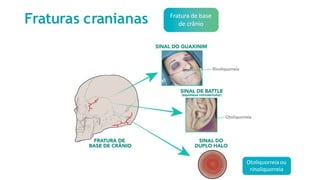 Fraturas cranianas Fratura de base
de crânio
Otoliquorreia ou
rinoliquorreia
 