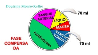Doutrina Monro-Kellie
70 ml
70 ml
FASE
COMPENSA
DA
 