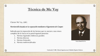 Mcvay Incision Tecnica-quirúrgica-hernioplastía-inguinal-1.pdf