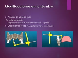 Modificaciones en la técnica
 Paladar de bóveda baja
- Torundas de algodón
- Angulación vertical. Aumentandola de 5 a 15 grados
 Crecimientos óseos (torus palatino y torus mandibular)
 