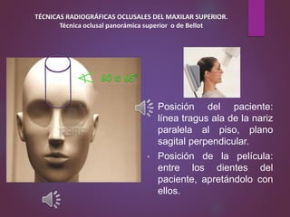 • Posición del paciente:
línea tragus ala de la nariz
paralela al piso, plano
sagital perpendicular.
• Posición de la película:
entre los dientes del
paciente, apretándolo con
ellos.
TÉCNICAS RADIOGRÁFICAS OCLUSALES DEL MAXILAR SUPERIOR.
Técnica oclusal panorámica superior o de Bellot
 