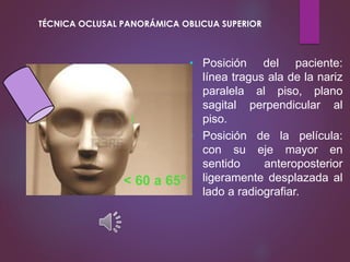 • Posición del paciente:
línea tragus ala de la nariz
paralela al piso, plano
sagital perpendicular al
piso.
• Posición de la película:
con su eje mayor en
sentido anteroposterior
ligeramente desplazada al
lado a radiografiar.
< 60 a 65°
TÉCNICA OCLUSAL PANORÁMICA OBLICUA SUPERIOR
 