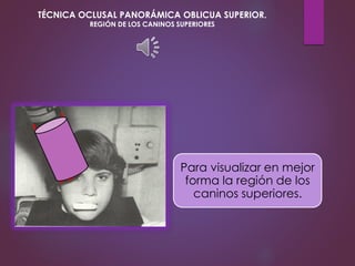 Para visualizar en mejor
forma la región de los
caninos superiores.
TÉCNICA OCLUSAL PANORÁMICA OBLICUA SUPERIOR.
REGIÓN DE LOS CANINOS SUPERIORES
 