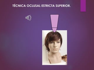 TÉCNICA OCLUSAL ESTRICTA SUPERIOR.
 