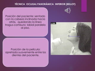 Posición del paciente: sentado
con la cabeza inclinada hacia
atrás, quedando la línea
tragus-comisura labial paralela
al piso.
Posición de la película:
apretada suavemente entre los
dientes del paciente.
TÉCNICA OCLUSAL PANORÁMICA INFERIOR (BELLOT)
 