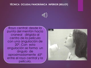 Rayo central: desde la
punta del mentón hacia
craneal dirigida al
centro de la película
con una angulación de
20°. Con esta
angulación se forma un
ángulo de
aproximadamente 65°
entre el rayo central y la
película.
TÉCNICA OCLUSAL PANORÁMICA INFERIOR (BELLOT)
 