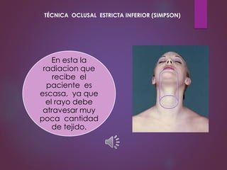 En esta la
radiacion que
recibe el
paciente es
escasa, ya que
el rayo debe
atravesar muy
poca cantidad
de tejido.
TÉCNICA OCLUSAL ESTRICTA INFERIOR (SIMPSON)
 