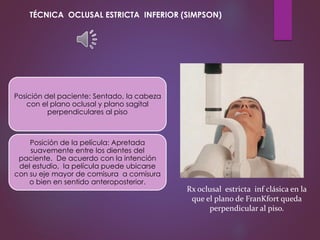 Posición del paciente: Sentado, la cabeza
con el plano oclusal y plano sagital
perpendiculares al piso
Posición de la película: Apretada
suavemente entre los dientes del
paciente. De acuerdo con la intención
del estudio, la película puede ubicarse
con su eje mayor de comisura a comisura
o bien en sentido anteroposterior.
Rx oclusal estricta inf clásica en la
que el plano de FranKfort queda
perpendicular al piso.
TÉCNICA OCLUSAL ESTRICTA INFERIOR (SIMPSON)
 