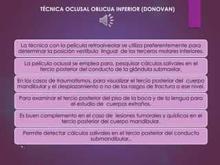 La técnica con la película retroalveolar se utiliza preferentemente para
determinar la posición vestíbulo lingual de los terceros molares inferiores.
La película oclusal se emplea para, pesquisar cálculos salivales en el
tercio posterior del conducto de la glándula submaxilar.
En los casos de traumatismos, para visualizar el tercio posterior del cuerpo
mandibular y el desplazamiento o no de los rasgos de fractura a ese nivel.
Para examinar el tercio posterior del piso de la boca y de la lengua para
el estudio de cuerpos extraños.
Es buen complemento en el caso de lesiones tumorales y quísticas en el
tercio posterior del cuerpo mandibular.
Permite detectar cálculos salivales en el tercio posterior del conducto
submandibular..
•.
TÉCNICA OCLUSAL OBLICUA INFERIOR (DONOVAN)
 