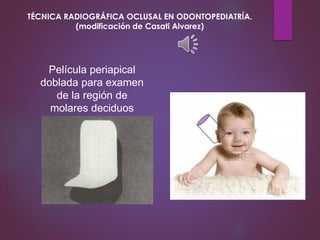 Película periapical
doblada para examen
de la región de
molares deciduos
TÉCNICA RADIOGRÁFICA OCLUSAL EN ODONTOPEDIATRÍA.
(modificación de Casati Alvarez)
 