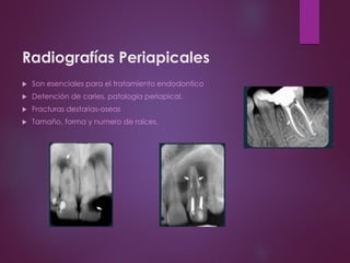 Radiografías Periapicales
 Son esenciales para el tratamiento endodontico
 Detención de caries, patología periapical.
 Fracturas destarias-oseas
 Tamaño, forma y numero de raíces.
 
