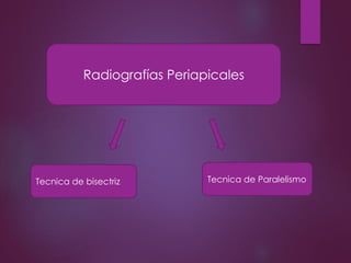 Tecnica de Paralelismo
Radiografías Periapicales
Tecnica de bisectriz
 