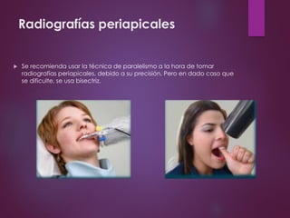 Radiografías periapicales
 Se recomienda usar la técnica de paralelismo a la hora de tomar
radiografías periapicales, debido a su precisión. Pero en dado caso que
se dificulte, se usa bisectriz.
 