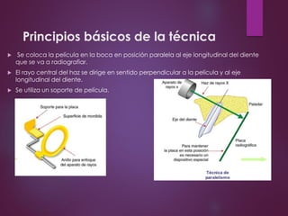 Principios básicos de la técnica
 Se coloca la película en la boca en posición paralela al eje longitudinal del diente
que se va a radiografiar.
 El rayo central del haz se dirige en sentido perpendicular a la película y al eje
longitudinal del diente.
 Se utiliza un soporte de película.
 