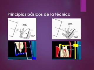 Principios básicos de la técnica
 