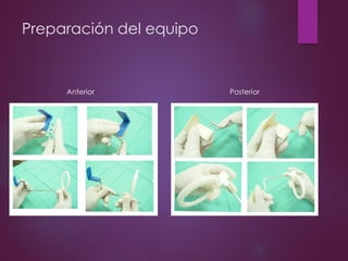 Preparación del equipo
Anterior Posterior
 