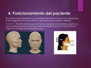 4. Posicionamiento del paciente
En la técnica de paralelismo las posiciones del paciente no son tan específicas
ni tan exigentes como en la técnica de bisectriz pero podrían utilizarse.
Posición 1. Posición utilizada para la toma radiográfica del maxilar superior. La
cual consiste en trazar una línea imaginaria desde el ala de la nariz hasta el
trago, la cual debe estar paralela al piso.
 