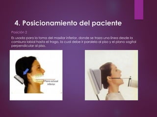 4. Posicionamiento del paciente
Posición 2
Es usada para la toma del maxilar inferior, donde se traza una línea desde la
comisura labial hasta el trago, la cual debe ir paralela al piso y el plano sagital
perpendicular al piso.
 