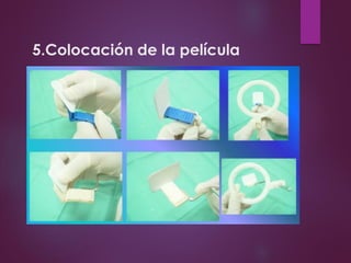 5.Colocación de la película
 