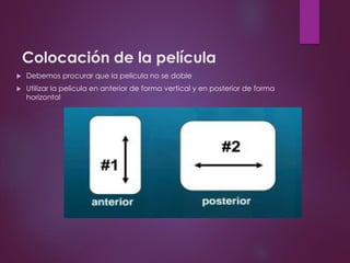 Colocación de la película
 Debemos procurar que la pelicula no se doble
 Utilizar la pelicula en anterior de forma vertical y en posterior de forma
horizontal
 