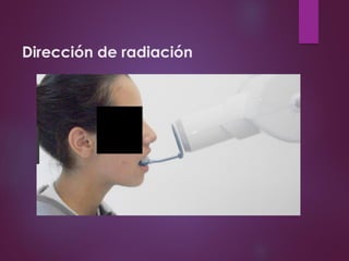 Dirección de radiación
 
