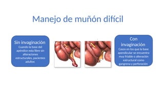 tecnica apendicetomia manejo y diagnóstico.pptx