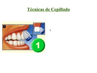 Técnicas de Cepillado



          1
 