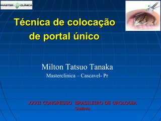 Técnica de colocação
de portal único
Milton Tatsuo Tanaka
Masterclinica – Cascavel- Pr

XXXII CONGRESSO BRASILEIRO DE UROLOGIA
Goiânia

 