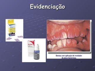 Evidenciação 