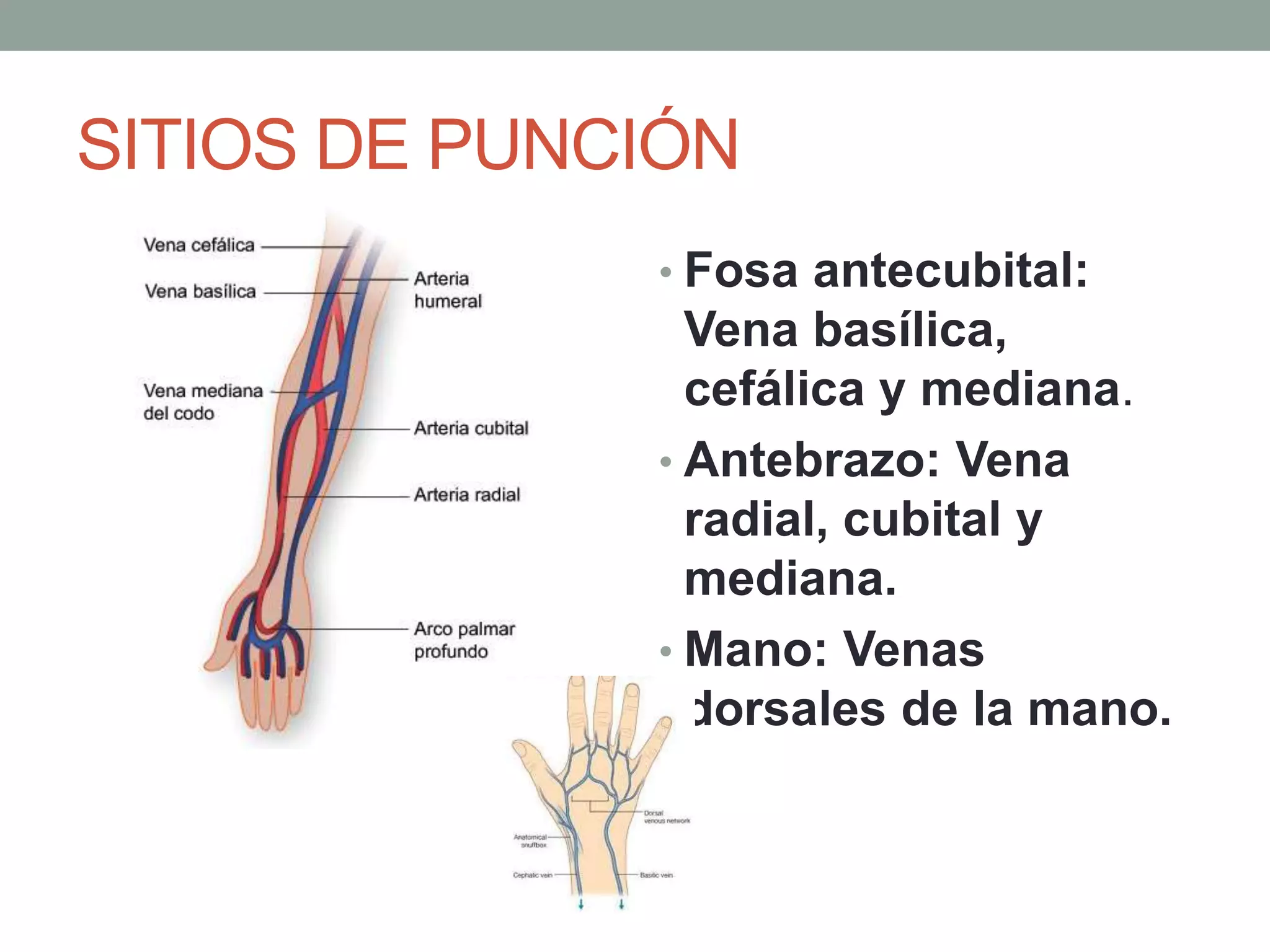 Técnica de punción venosa | PPTX