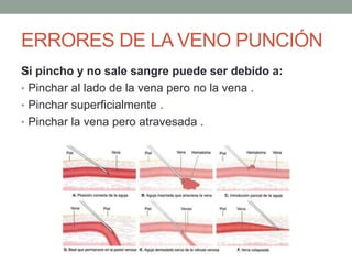 ERRORES DE LA VENO PUNCIÓN
Si pincho y no sale sangre puede ser debido a:
• Pinchar al lado de la vena pero no la vena .
• Pinchar superficialmente .
• Pinchar la vena pero atravesada .
 