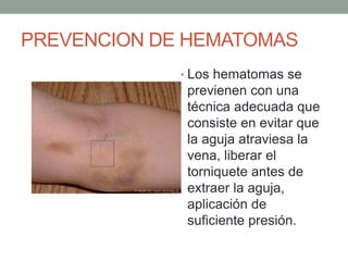 PREVENCION DE HEMATOMAS
• Los hematomas se
previenen con una
técnica adecuada que
consiste en evitar que
la aguja atraviesa la
vena, liberar el
torniquete antes de
extraer la aguja,
aplicación de
suficiente presión.
 