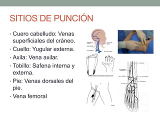 SITIOS DE PUNCIÓN
• Cuero cabelludo: Venas
superficiales del cráneo.
• Cuello: Yugular externa.
• Axila: Vena axilar.
• Tobillo: Safena interna y
externa.
• Pie: Venas dorsales del
pie.
• Vena femoral
 