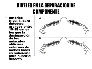NIVELES EN LA SEPARACIÓN DE
COMPONENTE
• anterior:
Nivel 1, para
defectos
grandes entre
10-15 cm en
los que la
desinserción
de los
músculos
oblicuos
externos de
ambos lados
es suficiente
para cubrir el
defecto
 